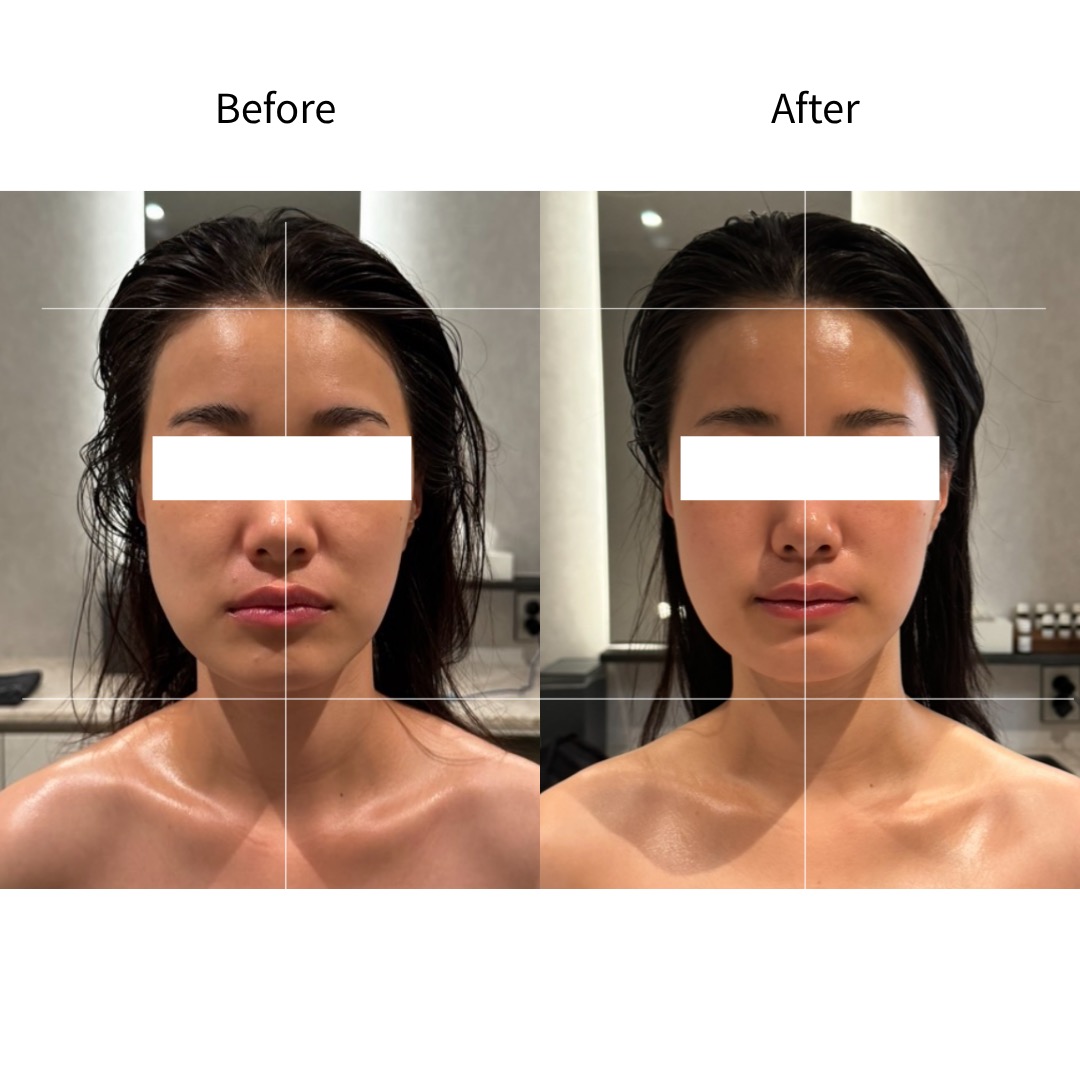 方下巴·面部均衡