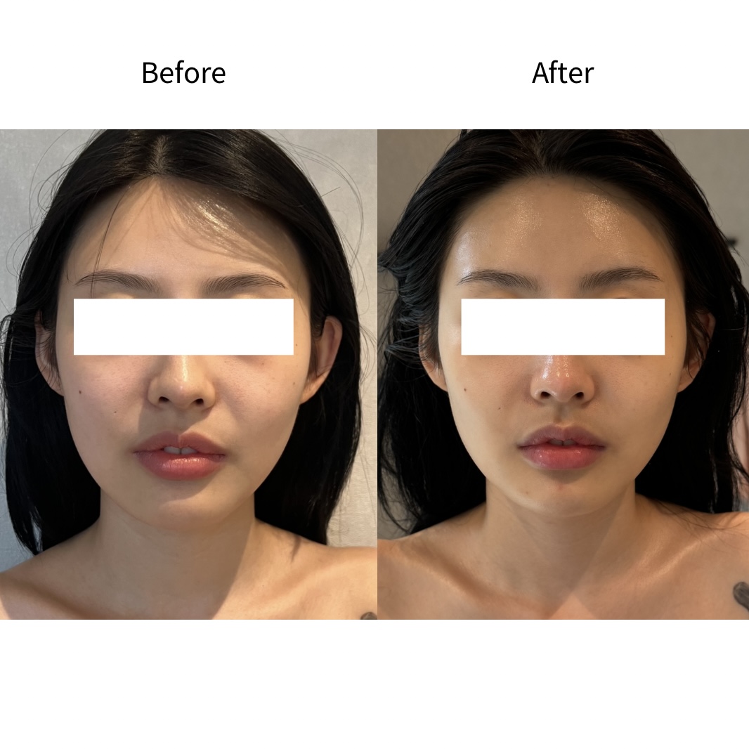 面部线条·对称均衡