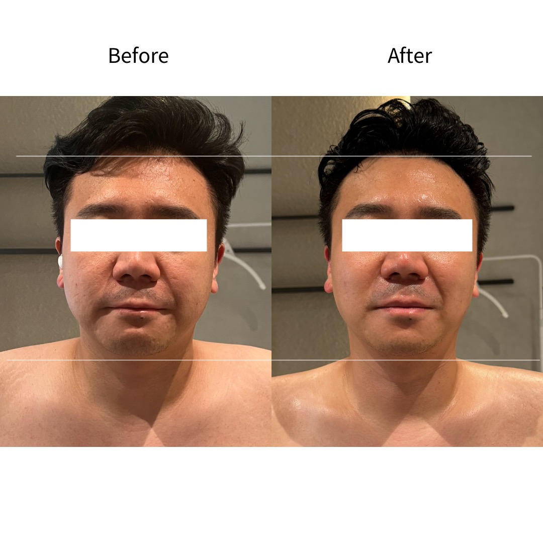 男士管理·面部缩小