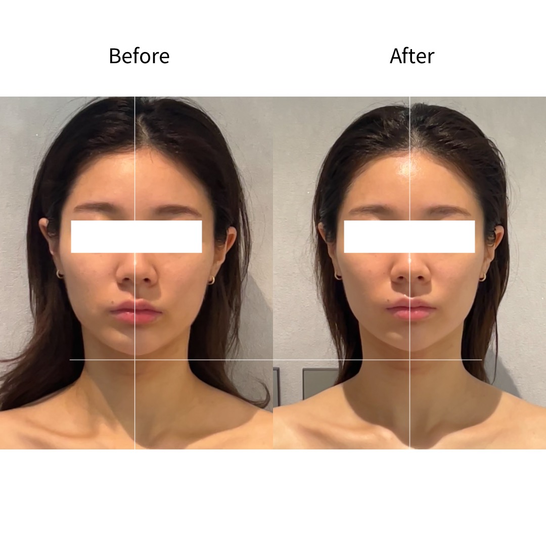 中庭长度·面部均衡